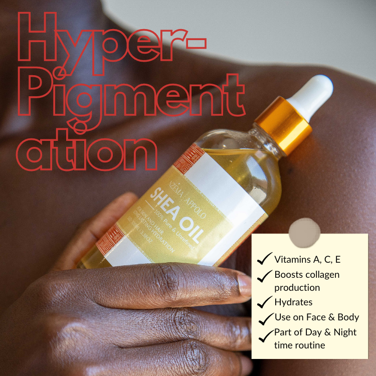 Nzema Appolo Cold-Pressed Hydrating Shea Oil 100ml - Dry Skin, Sensitive Skin