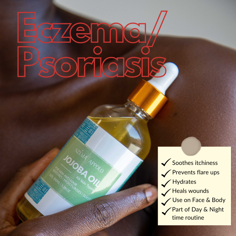 Nzema Appolo Cold-Pressed Hydrating Jojoba Oil 100ml - Super Oil, Eczema, Psoriasis, Premature Ageing