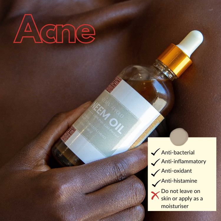 Nzema Appolo Cold-Pressed Antibacterial Neem Oil 100ml - Acne Prone Skin